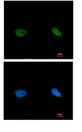 Immunocytochemistry/ Immunofluorescence - Anti-BCCIP antibody (AB97577)