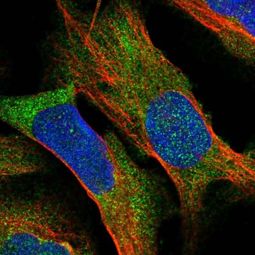 Immunocytochemistry/ Immunofluorescence - Anti-BCDIN3D antibody (AB122599)