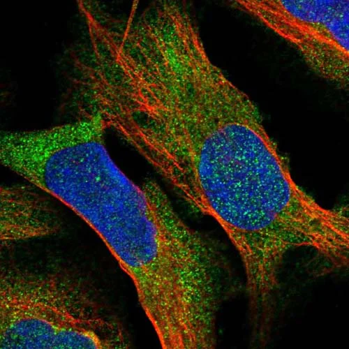 Immunocytochemistry/ Immunofluorescence - Anti-BCDIN3D antibody (AB122599)
