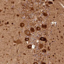 Immunohistochemistry (Formalin/PFA-fixed paraffin-embedded sections) - Anti-BCDIN3D antibody (AB122599)