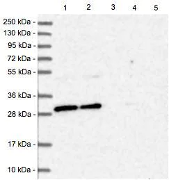 Western blot - Anti-BCDIN3D antibody (AB122599)