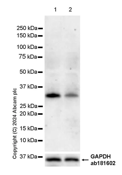 Western blot - Anti-BCDIN3D antibody [EPR28761-82] (AB317622)