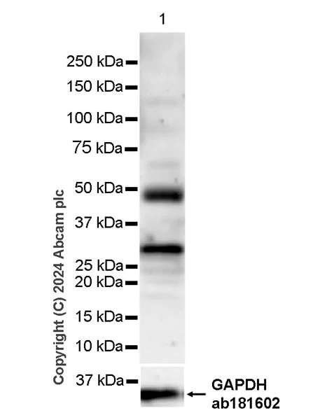 Western blot - Anti-BCDIN3D antibody [EPR28761-82] (AB317622)