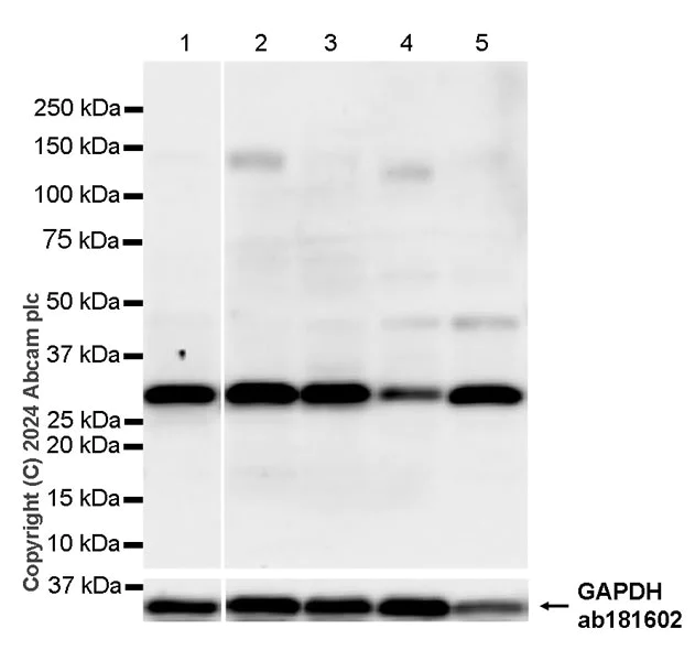 Western blot - Anti-BCDIN3D antibody [EPR28761-82] - BSA and Azide free (AB317623)