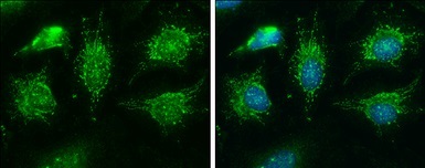 Immunocytochemistry/ Immunofluorescence - Anti-BCKDHA antibody (AB126173)