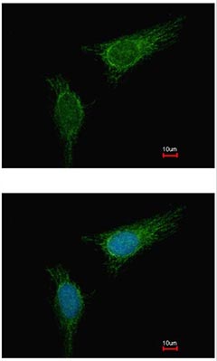 Immunocytochemistry/ Immunofluorescence - Anti-BCKDHA antibody (AB126173)