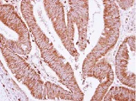 Immunohistochemistry (Formalin/PFA-fixed paraffin-embedded sections) - Anti-BCKDHA antibody (AB126173)
