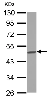 Western blot - Anti-BCKDHA antibody (AB126173)