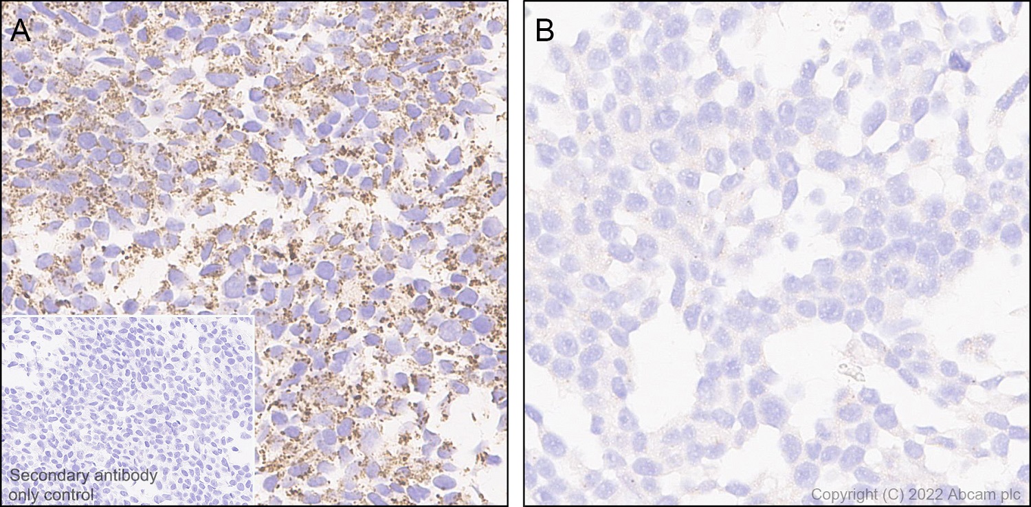 Immunohistochemistry (Formalin/PFA-fixed paraffin-embedded sections) - Anti-BCKDHA antibody [EPR27003-11] (AB305168)