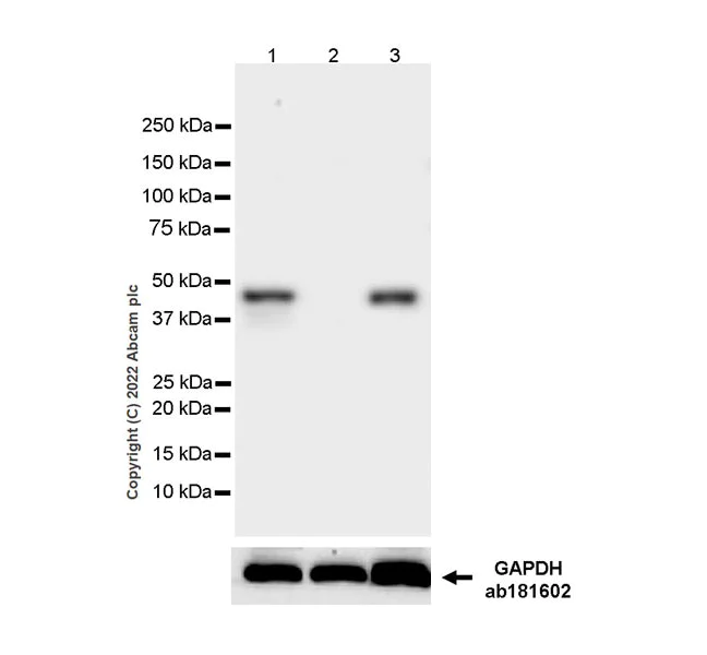 Western blot - Anti-BCKDHA antibody [EPR27003-11] (AB305168)