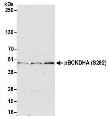 Western blot - Anti-BCKDHA (phospho S292) antibody (AB200577)