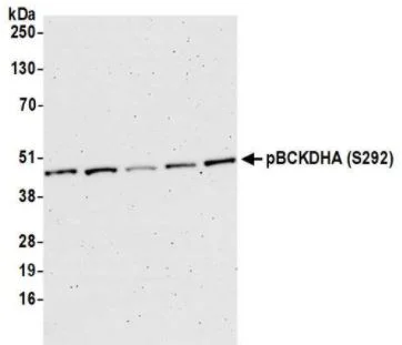 Western blot - Anti-BCKDHA (phospho S292) antibody (AB200577)