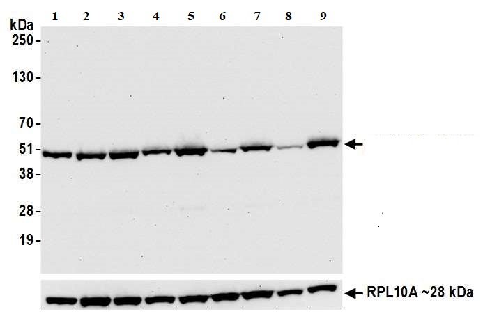 Western blot - Anti-BCKDHA (phospho S292) antibody [BLR060F] (AB275961), expandable thumbnail