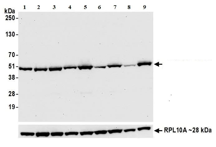 Western blot - Anti-BCKDHA (phospho S292) antibody [BLR060F] (AB275961)