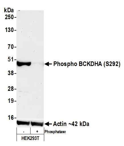 Western blot - Anti-BCKDHA (phospho S292) antibody [BLR060F] (AB275961)