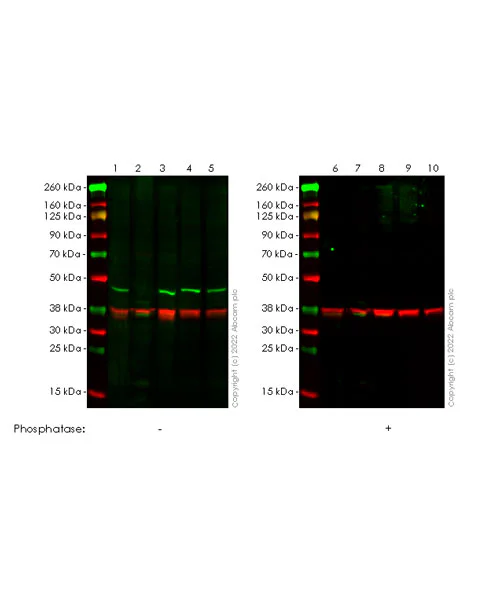 Western blot - Anti-BCKDHA (phospho S292) antibody [EPR27489-76] (AB302504)