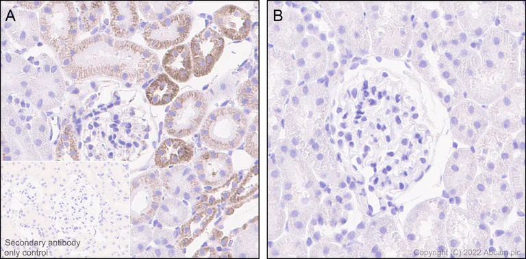 Immunohistochemistry (Formalin/PFA-fixed paraffin-embedded sections) - Anti-BCKDHA (phospho S292) antibody [EPR27489-76] - BSA and Azide free (AB302505)