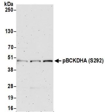 Anti-BCKDHA (phospho S293) antibody