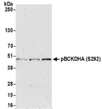 Western blot - Anti-BCKDHA (phospho S293) antibody (AB200577)