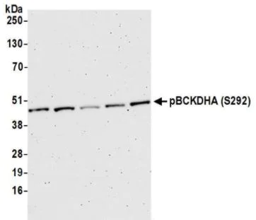Western blot - Anti-BCKDHA (phospho S293) antibody (AB200577)