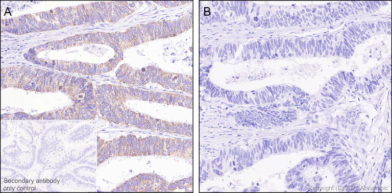 Immunohistochemistry (Formalin/PFA-fixed paraffin-embedded sections) - Anti-BCKDHA (phospho S293) antibody [EPR27489-76] - BSA and Azide free (AB302505)