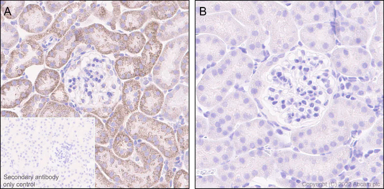 Immunohistochemistry (Formalin/PFA-fixed paraffin-embedded sections) - Anti-BCKDHA (phospho S293) antibody [EPR27489-76] - BSA and Azide free (AB302505)