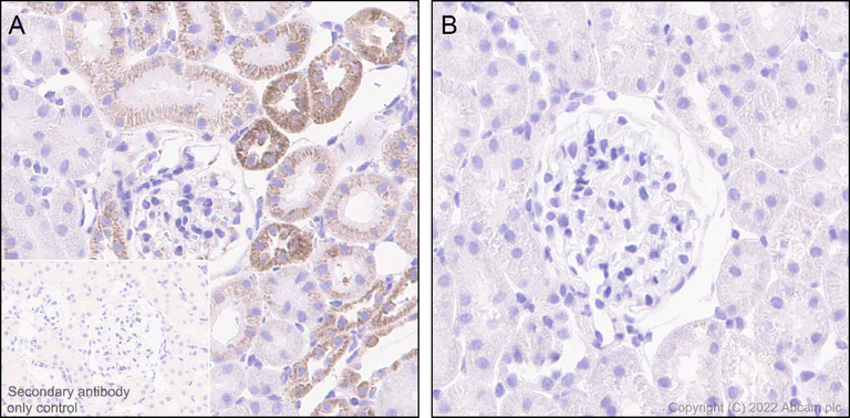 Immunohistochemistry (Formalin/PFA-fixed paraffin-embedded sections) - Anti-BCKDHA (phospho S293) antibody [EPR27489-76] - BSA and Azide free (AB302505)