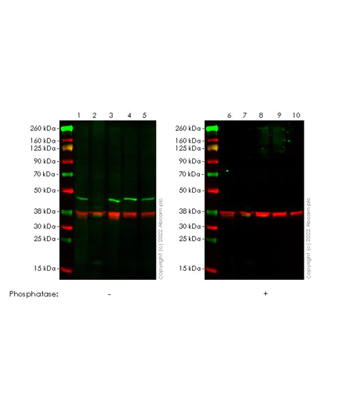 Western blot - Anti-BCKDHA (phospho S293) antibody [EPR27489-76] - BSA and Azide free (AB302505)