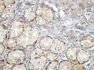 Immunohistochemistry (Formalin/PFA-fixed paraffin-embedded sections) - Anti-BCKDHB antibody (AB201225)