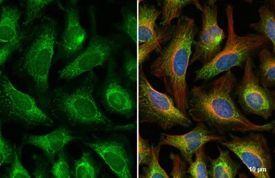 Immunocytochemistry/ Immunofluorescence - Anti-BCKDK antibody (AB151297)