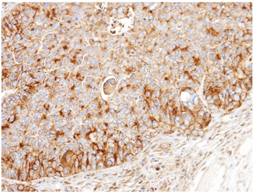 Immunohistochemistry (Formalin/PFA-fixed paraffin-embedded sections) - Anti-BCKDK antibody (AB151297), expandable thumbnail