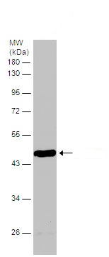 Western blot - Anti-BCKDK antibody (AB151297), expandable thumbnail