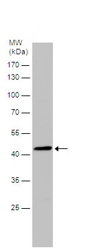 Western blot - Anti-BCKDK antibody (AB151297), expandable thumbnail