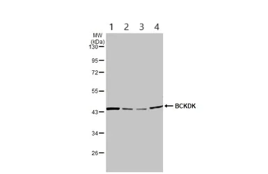 Western blot - Anti-BCKDK antibody (AB151297)