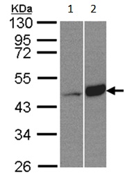 Western blot - Anti-BCKDK antibody (AB151297), expandable thumbnail