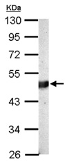 Western blot - Anti-BCKDK antibody (AB151297), expandable thumbnail