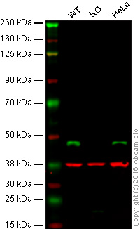 Western blot - Anti-BCKDK antibody [EPR7564] (AB128935)