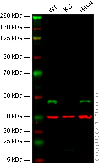 Western blot - Anti-BCKDK antibody [EPR7564] - BSA and Azide free (AB248230)