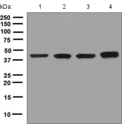 Western blot - Anti-BCKDK antibody [EPR7564] - BSA and Azide free (AB248230)