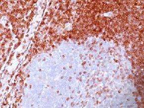 Immunohistochemistry (Formalin/PFA-fixed paraffin-embedded sections) - Anti-Bcl-2 antibody [100/D5] - BSA and Azide free (AB212800)