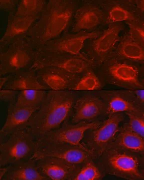 Immunocytochemistry/ Immunofluorescence - Anti-Bcl-2 antibody (AB194583)
