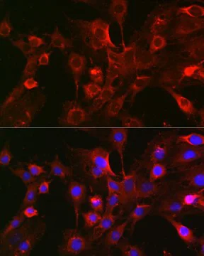 Immunocytochemistry/ Immunofluorescence - Anti-Bcl-2 antibody (AB194583)
