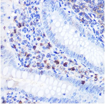 Immunohistochemistry (Formalin/PFA-fixed paraffin-embedded sections) - Anti-Bcl-2 antibody (AB194583)