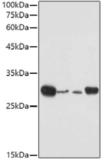 Western blot - Anti-Bcl-2 antibody (AB194583)