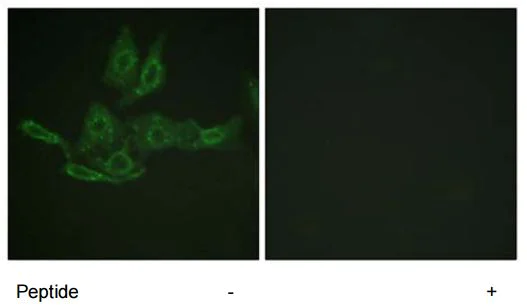 Immunocytochemistry/ Immunofluorescence - Anti-Bcl-2 antibody (AB59348)