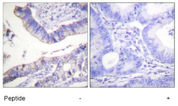 Immunohistochemistry (Formalin/PFA-fixed paraffin-embedded sections) - Anti-Bcl-2 antibody (AB59348)