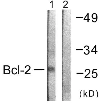 Western blot - Anti-Bcl-2 antibody (AB59348)