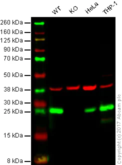 Western blot - Anti-Bcl-2 antibody [Bcl2/100] (AB117115)