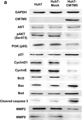 Western blot - Anti-Bcl-2 antibody [Bcl2/100] (AB117115)
