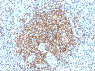 Immunohistochemistry (Formalin/PFA-fixed paraffin-embedded sections) - Anti-Bcl-2 antibody [BCL2/2210R] (AB238041)